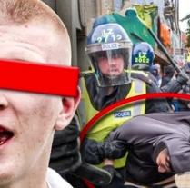 ‘Migrant hotel’ anger sparks clashes on UK streets photo